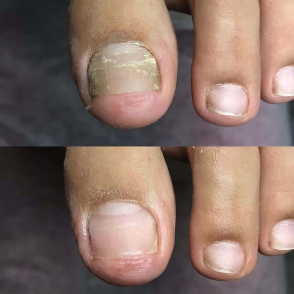 Nordic Nail Care penna i användning