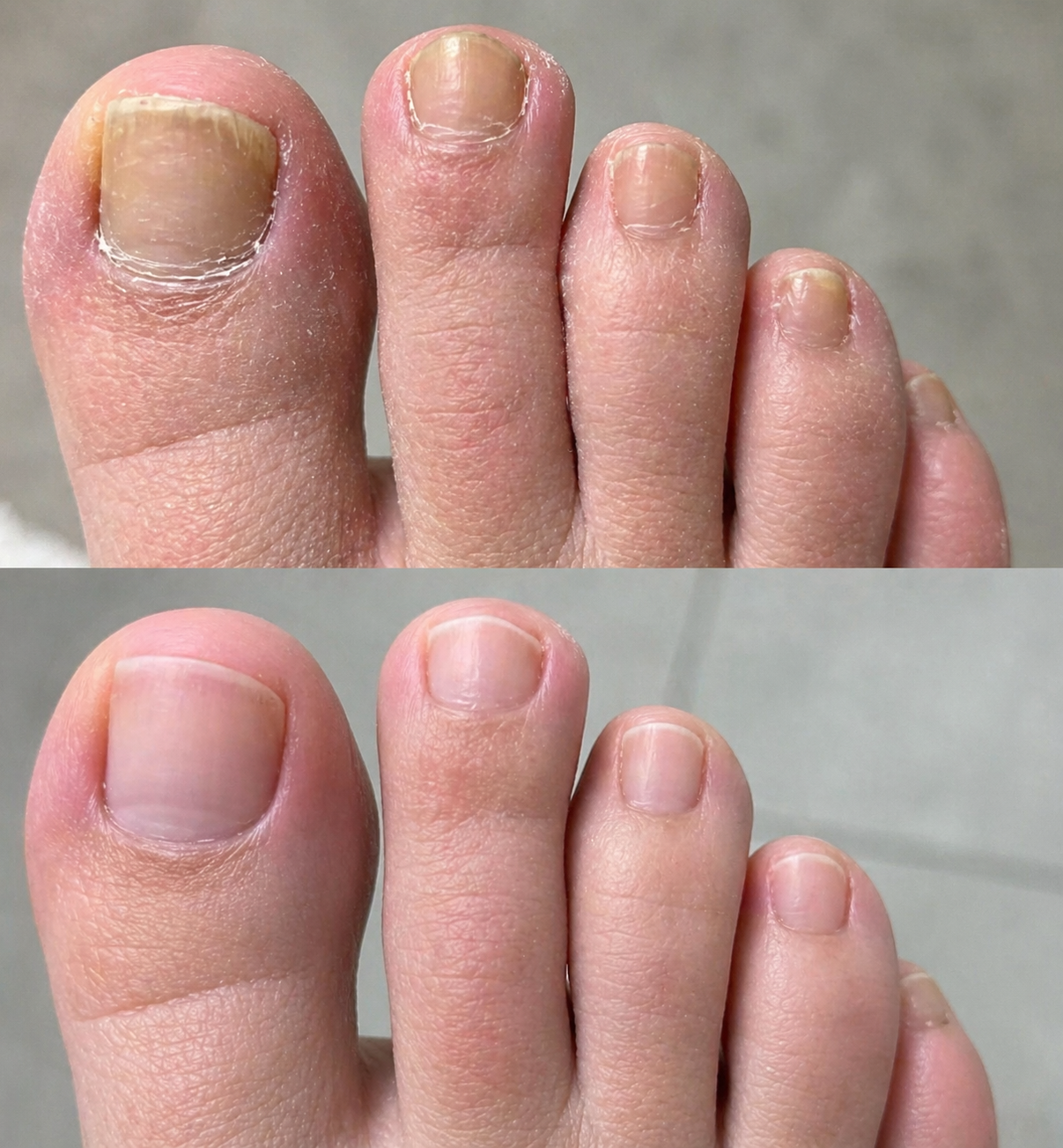 Kundbild med Nordic Nail Care nagelvård